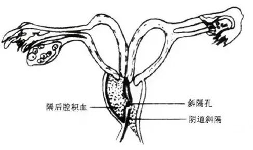 成都不孕不育医院
